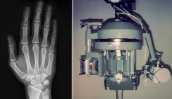 Update zu bildgebenden Verfahren in der Zahnmedizin (Teil 1)