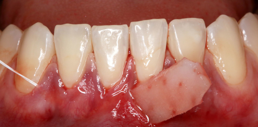 Weichgewebe: Unterschiede – Optimierung – Beeinflussung