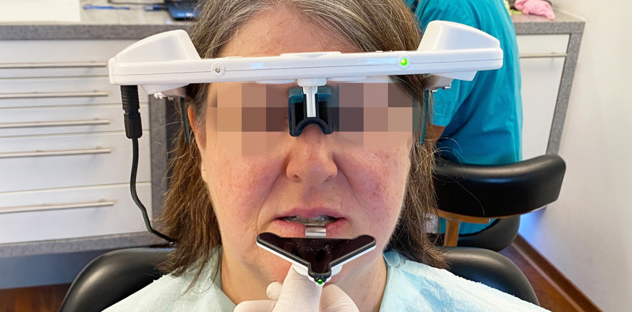 Kieferregistrierung bei Schnarchen und Schlafapnoe