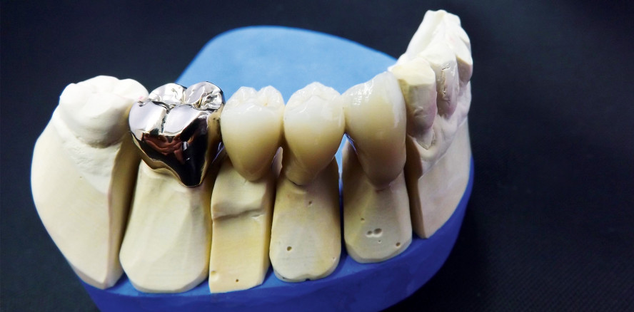 „Junge Zahnärzte begeistern sich für traditionelle Werkstoffe“