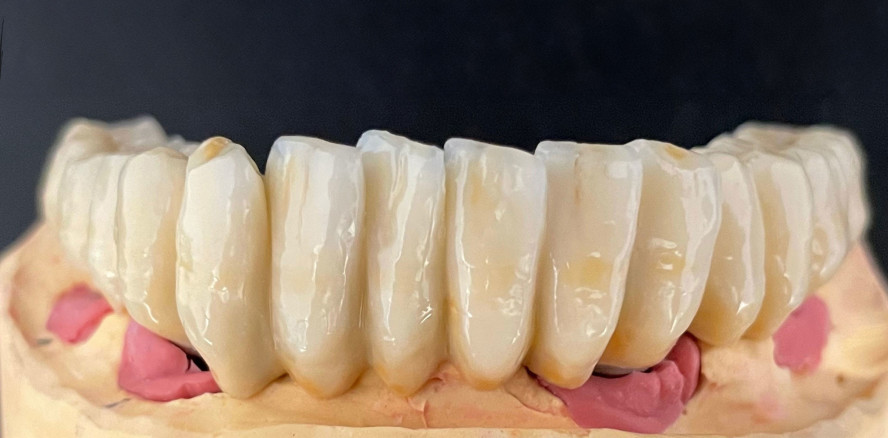 Zahnersatzmaterialien: Zahntechnik vs. UmweltZahnTechnik