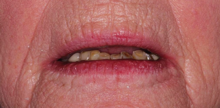 Der Umgang mit komplexen ästhetischen Wünschen im Alter