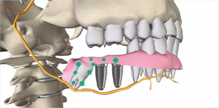 Biofeedback-Anästhesie – Die Anästhesie der Zukunft?