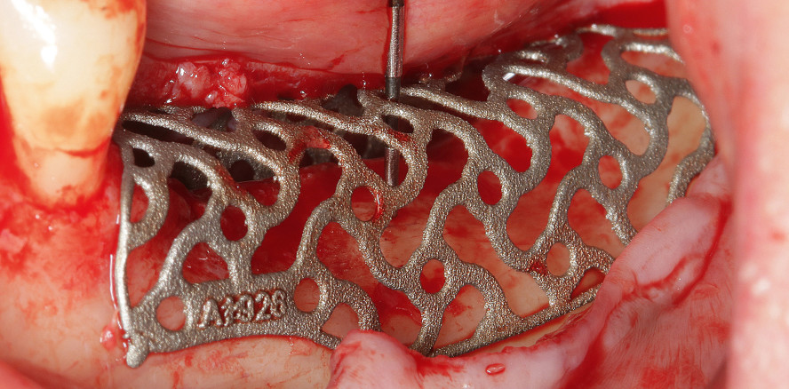 Vereinfachte 3D-Augmentationen mit CAD und modernen Materialien