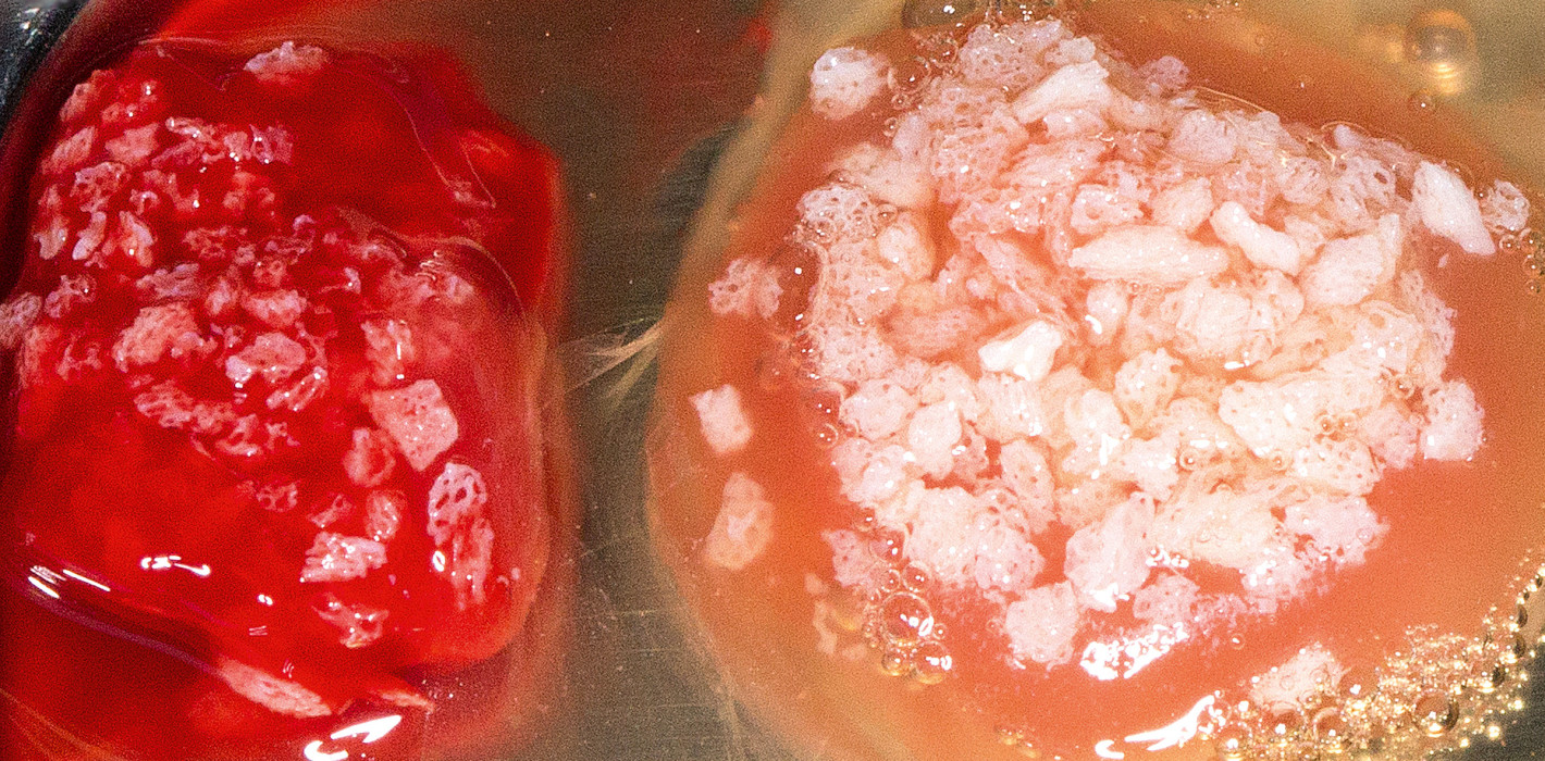 Periimplantäre Weichgewebeverdickung – stabil und funktionell
