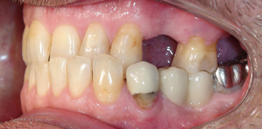 Digitale Kieferorthopädie im Fokus moderner 3D-DVT Diagnostik