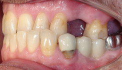 Digitale Kieferorthopädie im Fokus moderner 3D-DVT Diagnostik