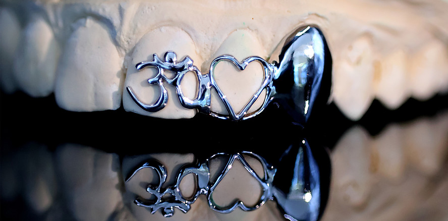 Digital gefertigter Grill aus CoCrMo-Legierung