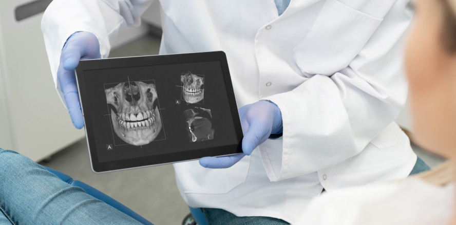 Behandlungsplanung in der Endodontie mittels DVT-Technologie