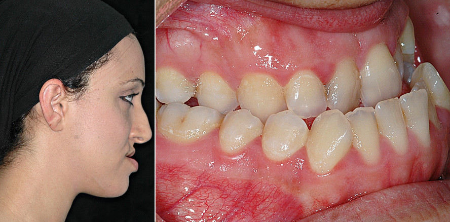 Kieferorthopädische Therapie: Die ästhetische Achse