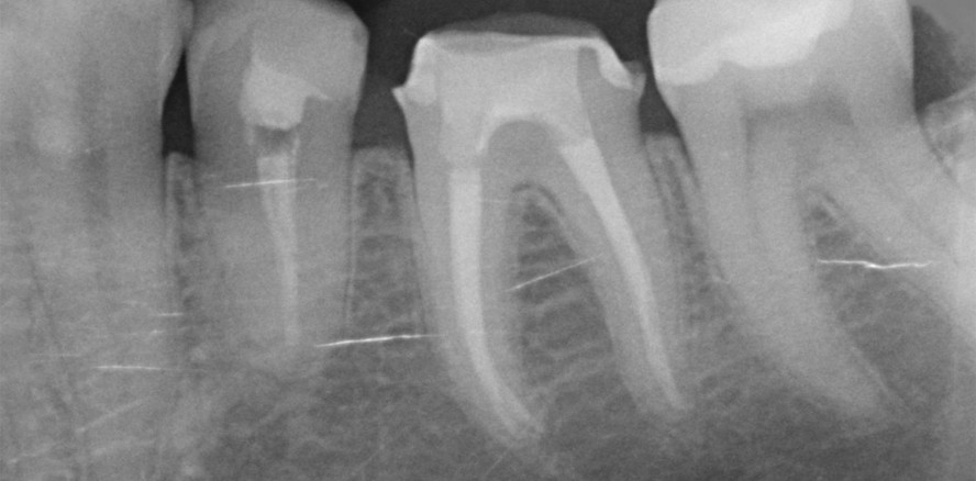 I can’t get no disinfection: Spülen – Warum, womit und wie?