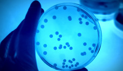 Mikrobiologische Grundlagen der PA-Therapie