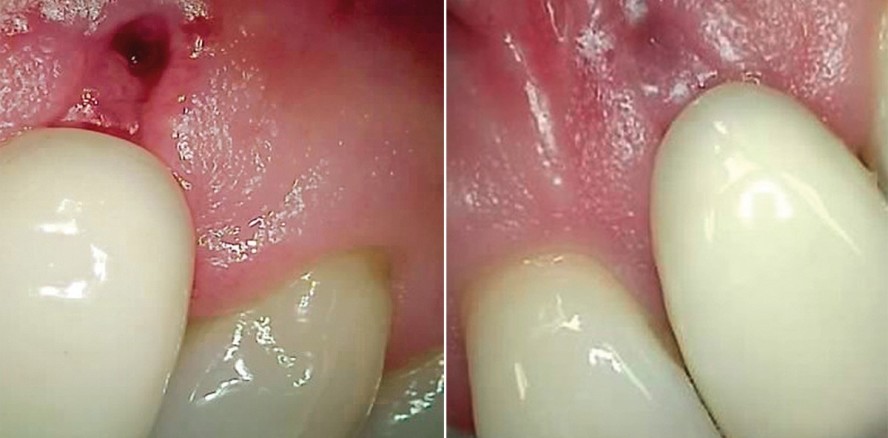 Mundduschen: Im Einsatz für eine erhöhte Patientencompliance