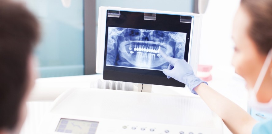 Digitalisierung in der Implantologie: Lohnt sich die DVT?