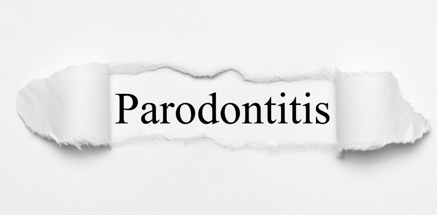 Fazit: Die parodontale Therapie ist überholt und braucht ein Update