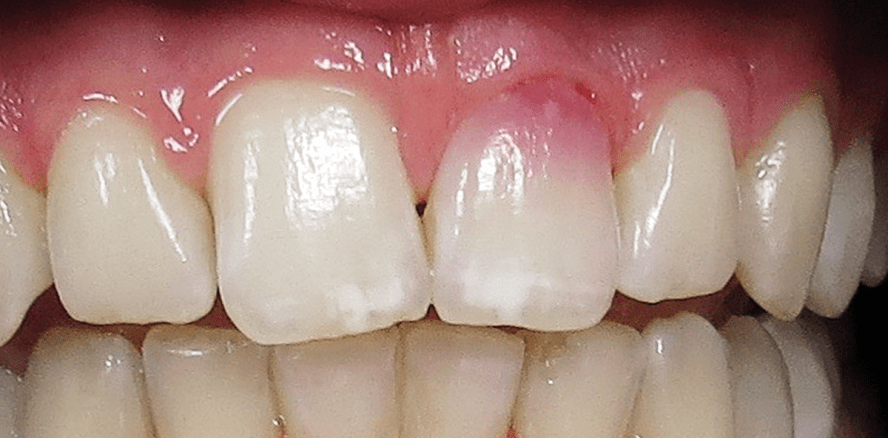 Pink Spot – Was nun?