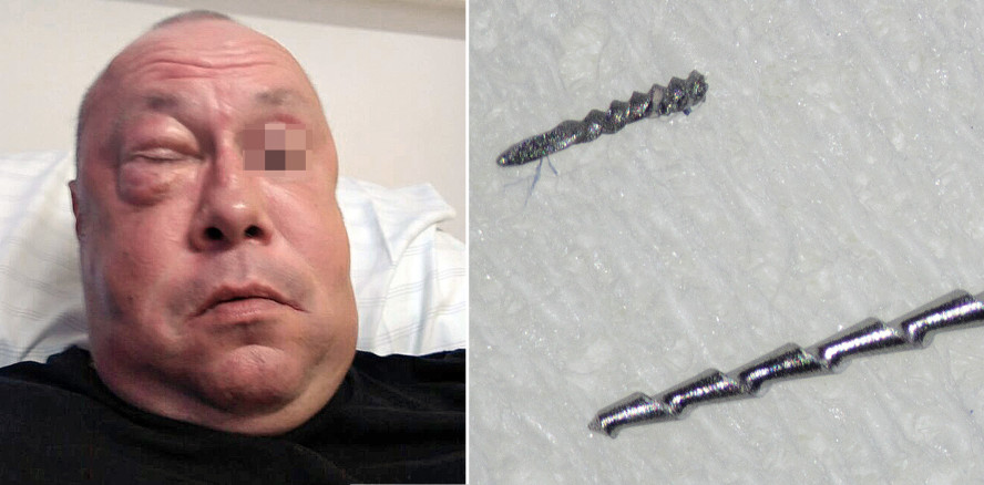 Endodontische Komplikationen – Prävention und Management