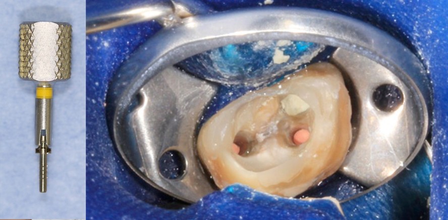 Behandlungskonzept des Generalisten: Eine Frage der Technik?