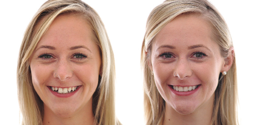 Die Welt der Zähne aus dem Blickwinkel der Moderne