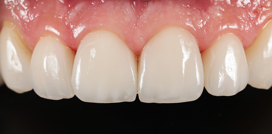 Langzeitstabile Ergebnisse in Funktion und Ästhetik