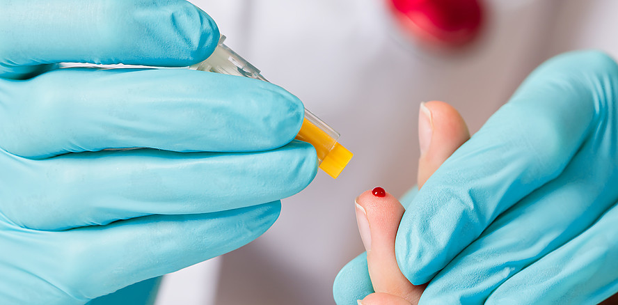 Parodontitis, systemische Entzündung & Omega-3: Ein präventiver Ansatz für die Dentalhygiene