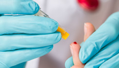 Parodontitis, systemische Entzündung & Omega-3: Ein präventiver Ansatz für die Dentalhygiene