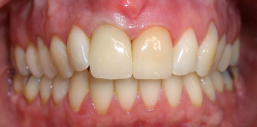 Target des nichtinstrumentellen Biofilmmanagements