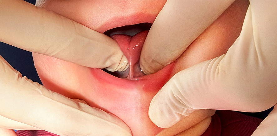 Klinische Relevanz zwischen Überdiagnose und differenzierter Therapieentscheidung