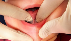 Klinische Relevanz zwischen Überdiagnose und differenzierter Therapieentscheidung