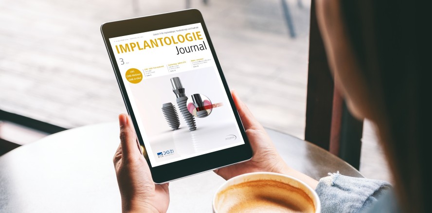 Thema Gewebestabilität im aktuellen Implantologie Journal