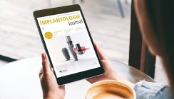 Thema Gewebestabilität im aktuellen Implantologie Journal