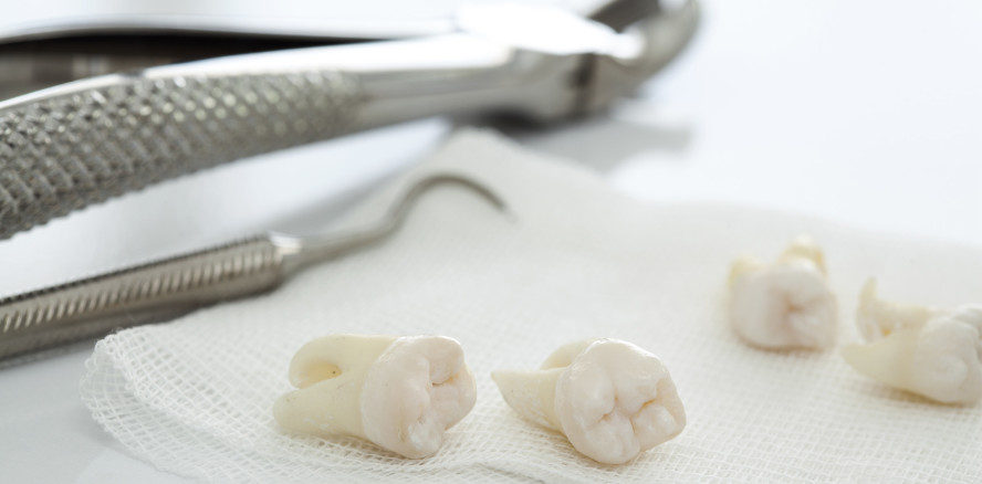 19 gesunde Zähne gezogen – Zahnarzt vor Gericht