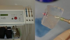 Einsatz von Diodenlasern in der zahnärztlichen Chirurgie