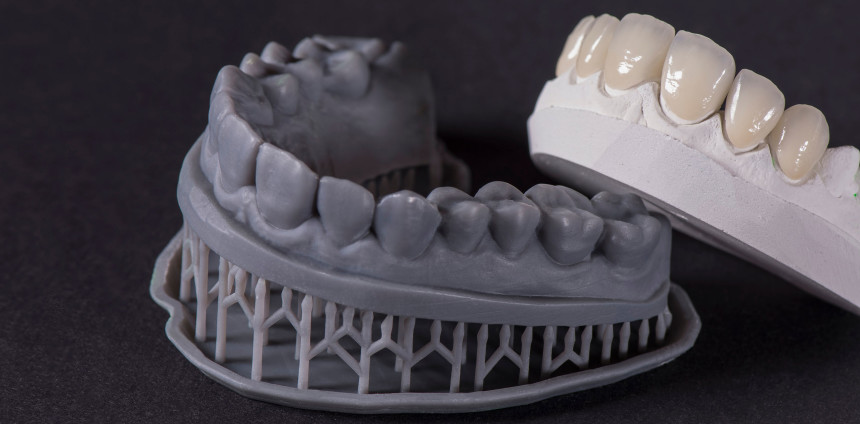 Zähne Aus Dem 3d Drucker www.zwp-online.info