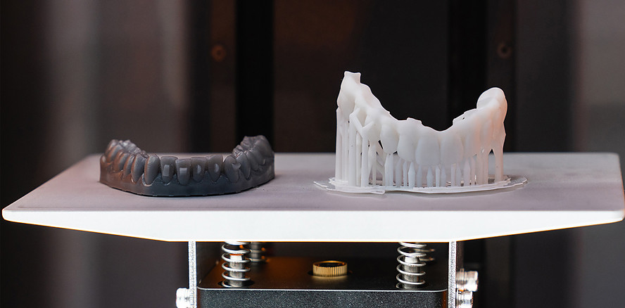 3D-Druck von Keramik: Zukunftsfeld der digitalen dentalen Fertigung