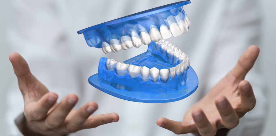 Zahnprothesen aus dem 3-D-Drucker: Gut und günstig?