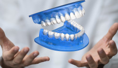 Zahnprothesen aus dem 3-D-Drucker: Gut und günstig?