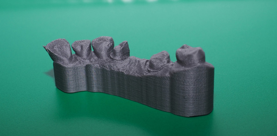Herstellung und Anwendung des 3D-Drucks im Praxislabor