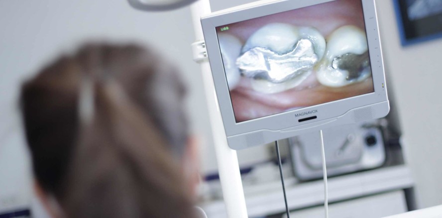 Amalgamverbot – Die bedenklichen Pläne der EU-Kommission