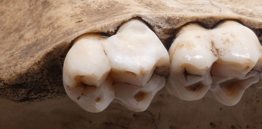 Aminosäuren im Zahnschmelz geben Essgewohnheiten preis