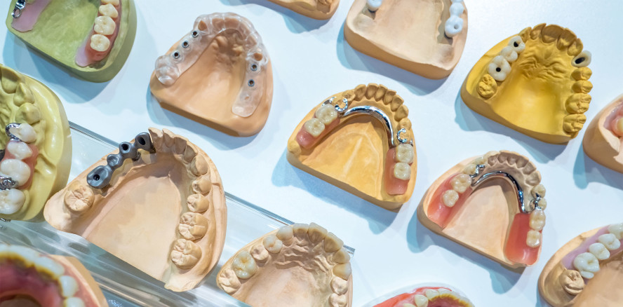 Kommt bald eine neue Vergütungs­regulierung für Zahntechniker?