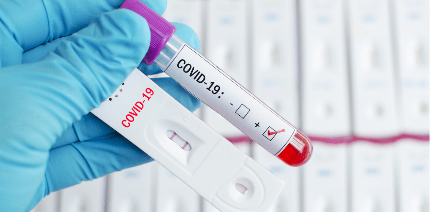 Anspruch auf PCR-Test künftig erst nach positivem Schnelltest