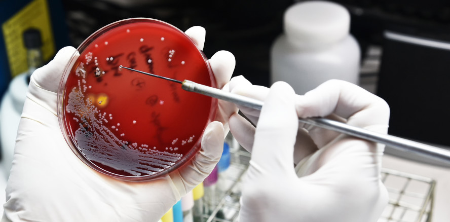 Tödliche Antibiotikaresistenzen nehmen zu