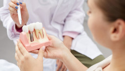 Stiftzahn oder Implantat – wo ist der Unterschied? – ZWP online – das  Nachrichtenportal für die Dentalbranche