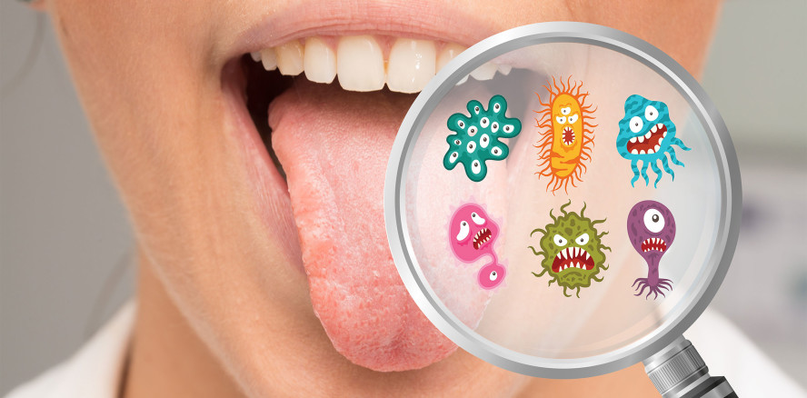 Forscher: Bakterien im Mund können depressiv machen