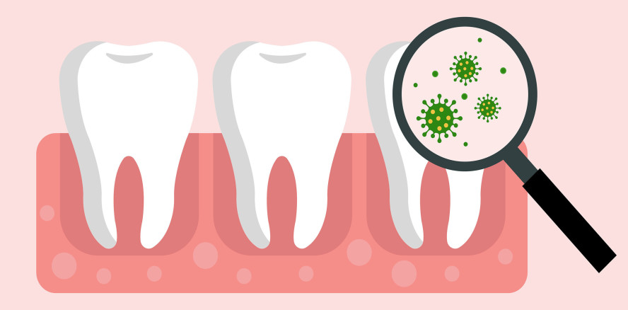 Diese Bakterien kommen bei oralen Infektionen vor