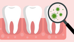 Diese Bakterien kommen bei oralen Infektionen vor