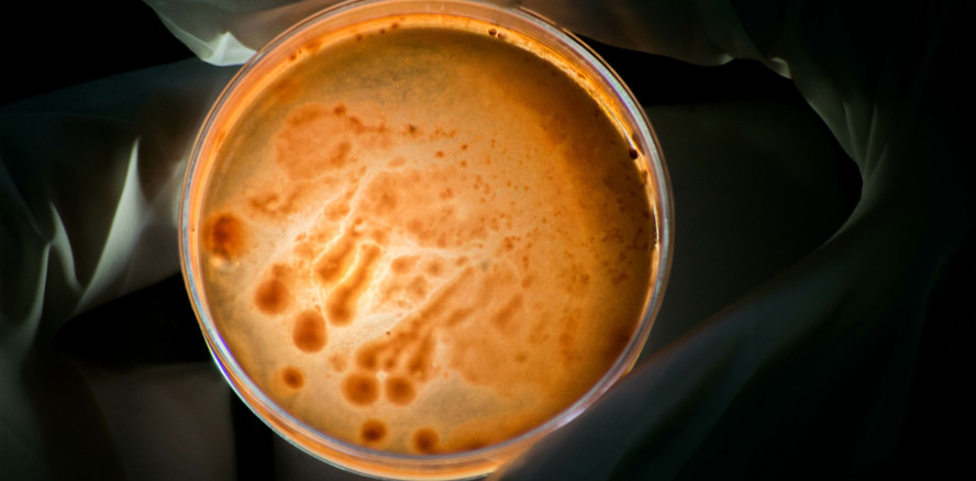 Coronavirus in bakteriellem Zahnbelag identifiziert