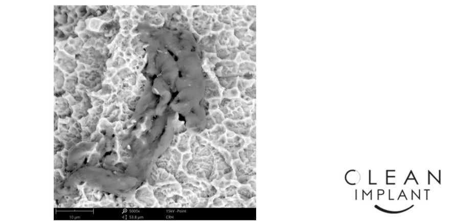 Verunreinigungen in bisher nicht bekanntem Ausmaß auf Implantaten
