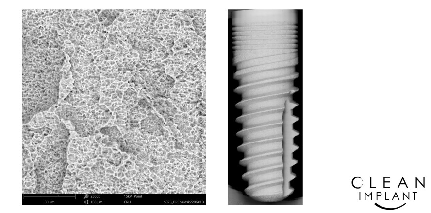 CleanImplant verleiht Qualitätssiegel auf der EAO in Wien